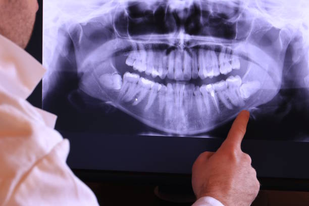 Best Weekend Emergency Dentist in Stanton, TX