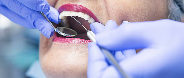 Best Emergency Dental Care for Abscessed Tooth in Stanton, TX